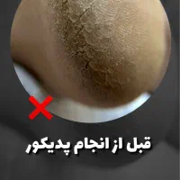 پدیکور تخصصی|خدمات آرایشگری و زیبایی|کرج, اتحاد|دیوار