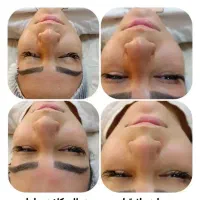 پاکسازی و فشیال پوست|خدمات آرایشگری و زیبایی|قم, حنیف نژاد|دیوار