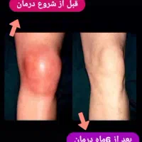 درمانگر بیماری روماتیسم و درد مفاصل|خدمات آرایشگری و زیبایی|اصفهان, شهرک سلامت|دیوار