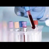 انجام آزمایش در منزل به صورت رایگان