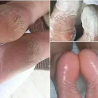 کفسابی پدیکور و رفع تیرگی تخفیف ب مدت ۲ روز|خدمات آرایشگری و زیبایی|فولادشهر, B2|دیوار