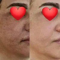 کرم گلدن شاین سفید کننده و ضد لک پر قدرت اصل|آرایشی، بهداشتی، درمانی|شیراز, اصلاح‌نژاد|دیوار