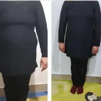 معجزه لاغری|آرایشی، بهداشتی، درمانی|قم, انسجام|دیوار