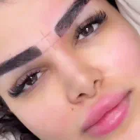 کاشت ابرو