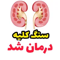 درمان قطعی و ریشه ای سنگ کلیه