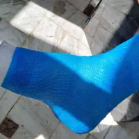 گچ گرفتن و آتل گرفتن توسط کارشناس اتاق عمل|خدمات آرایشگری و زیبایی|قم, پردیسان|دیوار