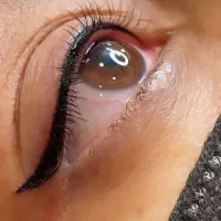 خدمات تتو و ژل و بوتاکس