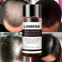 شامپو رزماری