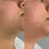 تخصصی پوست و مو و لیزر|خدمات آرایشگری و زیبایی|یاسوج, |دیوار