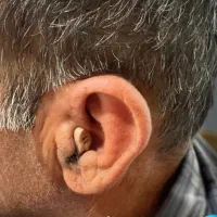 فروش سمعک بی واسطه بالاترین کیفیت واقعی ترین قیمت