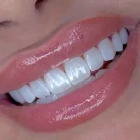 جشنواره VIP زیبایی لبخند در شیراز