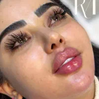 خدمات ژل فیلربوتاکس مزوژل درکلینیک با اف ویژه