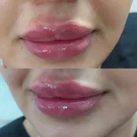 ژل وبوتاکس حمیدیه..|خدمات آرایشگری و زیبایی|حمیدیه, |دیوار