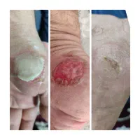 تونیک نانو وگان ( کلوئید نقره )