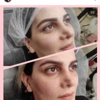 مدل میکروبلیدینگ ابرو|خدمات آرایشگری و زیبایی|گرگان, |دیوار