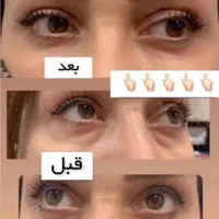 مشاوره تخصصی پوست ومو وپیشنهاد بهترین محصولات|آرایشی، بهداشتی، درمانی|مریوان, |دیوار