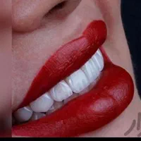 دندان مصنوعی