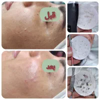 خدمات فیشال وپاکسازی