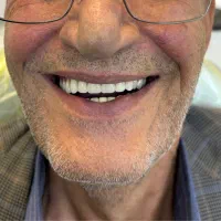 دندان مصنوعی و دندانسازی  اقساط