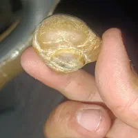 سنگ باباغوری