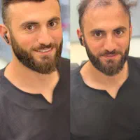 پروتزمو|خدمات آرایشگری و زیبایی|کرج, عظیمیه|دیوار