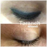 فوری مدل برای ریموو خط چشم همین امروز صبح