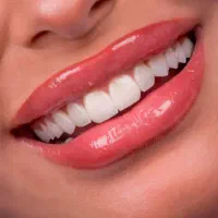 ایمپلنت عصبکشی ترمیم کشیدن|خدمات آرایشگری و زیبایی|تهران, دزاشیب|دیوار