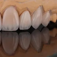 آموزش دندانسازی ( لابراتواری)