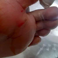 انواع تزریقات وپانسمان فصدبخیه وفیزیوتراپی درمنزل|خدمات آرایشگری و زیبایی|خرم‌آباد, |دیوار