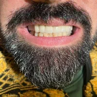 خدمات دندانسازی و دندانپزشکی|خدمات آرایشگری و زیبایی|ارومیه, |دیوار