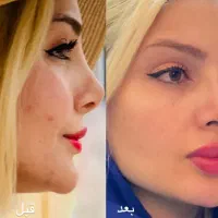 پوست کره ای و فیشال تخفیف