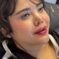 تخیف ویژه ژل لب فول فیس عربی فیلر گونه بوتاکس ۷۰۰