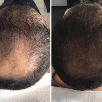 این اخرین روشیه که امتحان میکنی