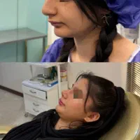 عمل زیبایی بینی با نازلترین قیمت