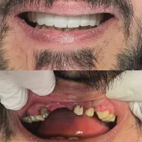 جشنواره دندانپزشکی در کرمانشاه