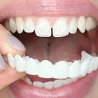 لمینت متحرک دندان|آرایشی، بهداشتی، درمانی|سنندج, |دیوار