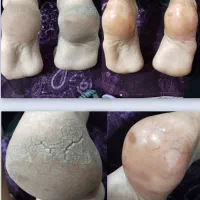 مدل برای پدیکور اسپا
