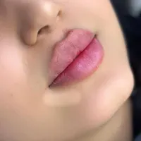 تزریق بوتاکس فیلر ژل لب روسی هایفو با تخفیف ویژه|خدمات آرایشگری و زیبایی|تهران, ستارخان|دیوار
