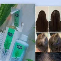 درمان ریزش موی سر|مواد شوینده و دستمال کاغذی|تبریز, |دیوار