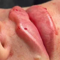 ژل فیلر آنزیم بوتاکس ناخن|خدمات آرایشگری و زیبایی|مرودشت, فرهنگ|دیوار