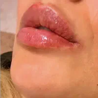 تخفیف ویژه افتتاحیه کلینیک زیبایی|خدمات آرایشگری و زیبایی|اردبیل, |دیوار