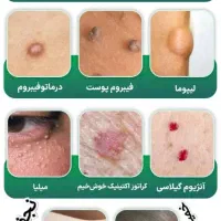 لیزرمو خانم300آقا600ریموتتوخال ژل بوتاکس لک پوستی|خدمات آرایشگری و زیبایی|نجف‌آباد, ویلاشهر|دیوار