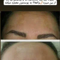 روغن درمانی  وروغن تراپی|آرایشی، بهداشتی، درمانی|مرند, |دیوار