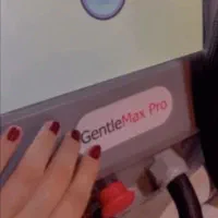 لیزر موهای زائد کندلا غیرتماسی