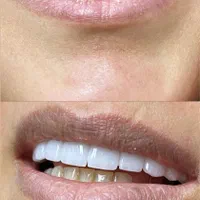 دندانپزشکی در آخونی|خدمات آرایشگری و زیبایی|تبریز, |دیوار