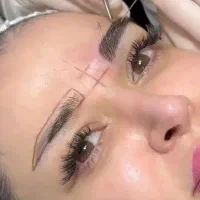 کاشت ابرو