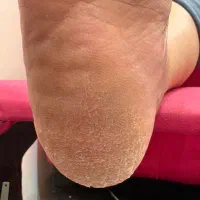 پدیکور ،کف سابی از۲۵۰تا۴۵۰