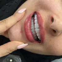 خدمات درمانی و زیبایی دندان|خدمات آرایشگری و زیبایی|کرمانشاه, |دیوار