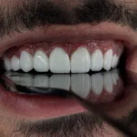 کامپوزیت فکی ۶/۹۰۰ تومان