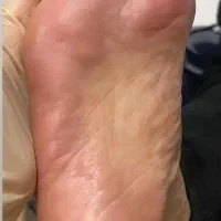 پدیکور فقط ۳۵۰|خدمات آرایشگری و زیبایی|ایذه, |دیوار